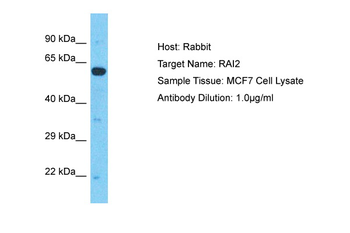 RAI2 Rabbit Polyclonal Antibody