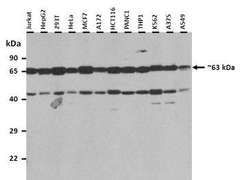 TENT4B Rabbit Polyclonal Antibody