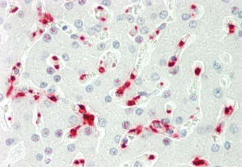 TENT4B Rabbit Polyclonal Antibody