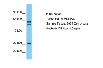 ALS2CL Rabbit Polyclonal Antibody