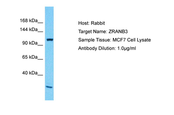ZRANB3 Rabbit Polyclonal Antibody