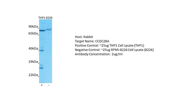 CCDC28A Rabbit Polyclonal Antibody