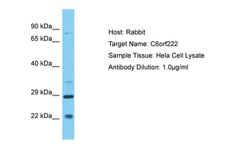 C6orf222 Rabbit Polyclonal Antibody