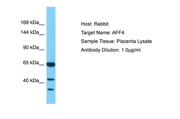 AFF4 Rabbit Polyclonal Antibody