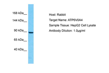 ATP6V0A4 Rabbit Polyclonal Antibody