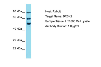 BRSK2 Rabbit Polyclonal Antibody