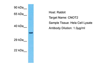 CNOT2 Rabbit Polyclonal Antibody