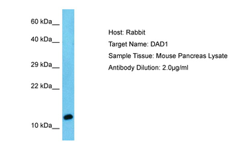 DAD1 Rabbit Polyclonal Antibody