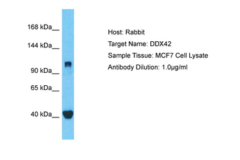 DDX42 Rabbit Polyclonal Antibody