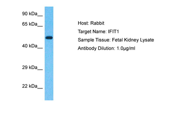 IFIT1 Rabbit Polyclonal Antibody
