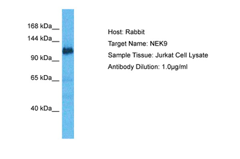 NEK9 Rabbit Polyclonal Antibody