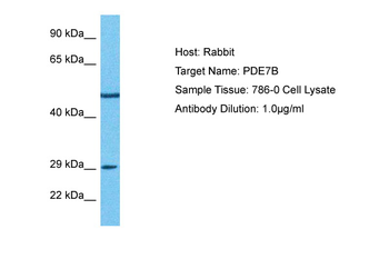 PDE7B Rabbit Polyclonal Antibody
