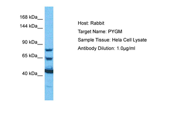 PYGM Rabbit Polyclonal Antibody