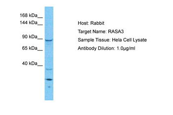 RASA3 Rabbit Polyclonal Antibody
