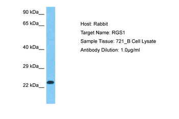 RGS1 Rabbit Polyclonal Antibody