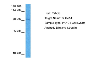 SLC4A4 Rabbit Polyclonal Antibody