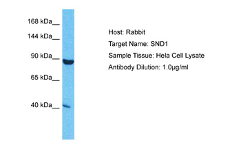 SND1 Rabbit Polyclonal Antibody