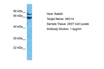 VAC14 Rabbit Polyclonal Antibody
