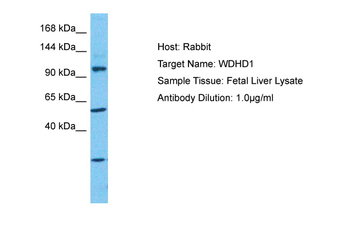 WDHD1 Rabbit Polyclonal Antibody