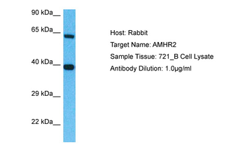 AMHR2 Rabbit Polyclonal Antibody