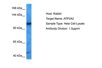 ATP2A2 Rabbit Polyclonal Antibody