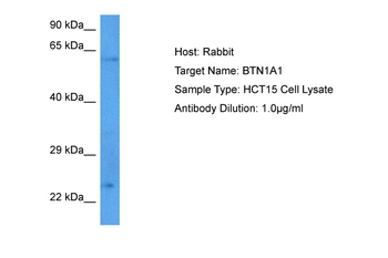 BTN1A1 Rabbit Polyclonal Antibody