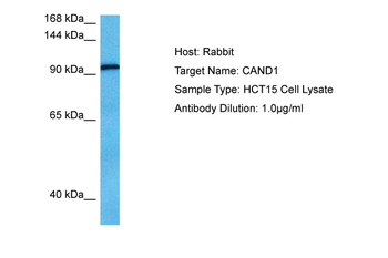 CAND1 Rabbit Polyclonal Antibody