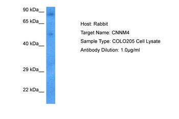CNNM4 Rabbit Polyclonal Antibody