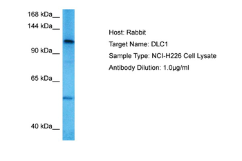 DLC1 Rabbit Polyclonal Antibody