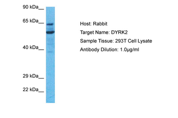 DYRK2 Rabbit Polyclonal Antibody