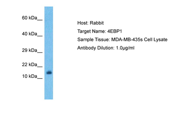 EIF4EBP1 Rabbit Polyclonal Antibody