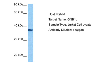 GNB1L Rabbit Polyclonal Antibody