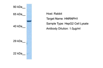 HNRNPH1 Rabbit Polyclonal Antibody
