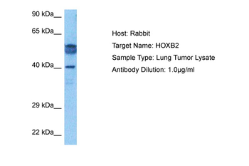 HOXB2 Rabbit Polyclonal Antibody