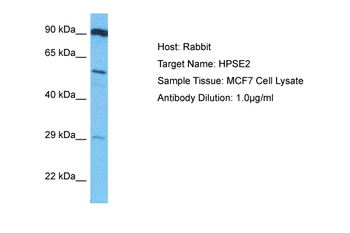 HPSE2 Rabbit Polyclonal Antibody