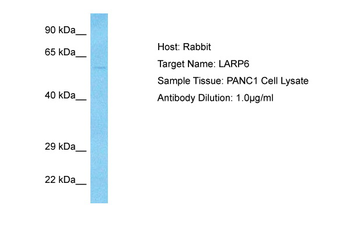 LARP6 Rabbit Polyclonal Antibody