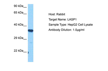 LASP1 Rabbit Polyclonal Antibody