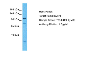 MAP4 Rabbit Polyclonal Antibody