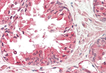 MAP4 Rabbit Polyclonal Antibody