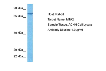 MTA2 Rabbit Polyclonal Antibody