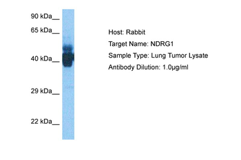 NDRG1 Rabbit Polyclonal Antibody