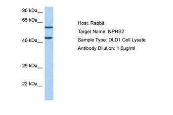 NPHS2 Rabbit Polyclonal Antibody