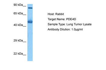 PDE4D Rabbit Polyclonal Antibody