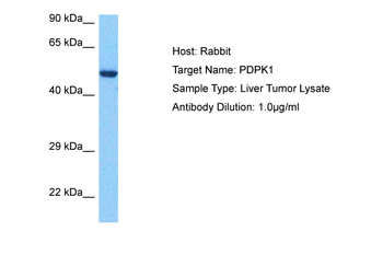 PDPK1 Rabbit Polyclonal Antibody