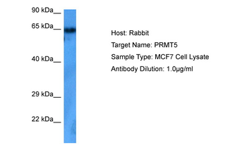 PRMT5 Rabbit Polyclonal Antibody