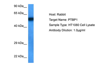 PTBP1 Rabbit Polyclonal Antibody