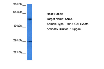 SNX4 Rabbit Polyclonal Antibody