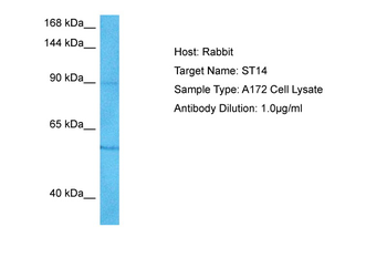 ST14 Rabbit Polyclonal Antibody