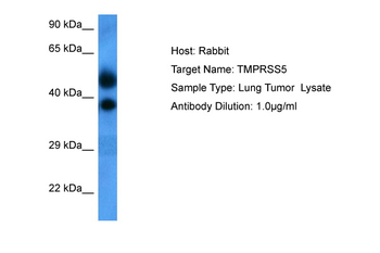 TMPRSS5 Rabbit Polyclonal Antibody