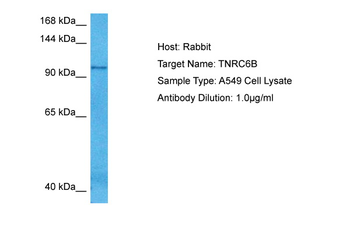 TNRC6B Rabbit Polyclonal Antibody